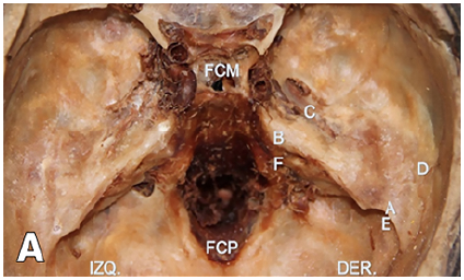 Puntos de referencia sobre la cara interna de la base del cr&aacute;neo, vista superior A, B, C, D, E, F: Puntos de referencia para la extracci&oacute;n, FCM: Fosa craneal media, FCP: Fosa craneal posterior, IZQ: Izquierda, DER: Derecha.