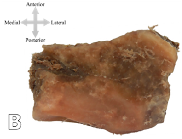 Pieza paralelep&iacute;peda extra&iacute;da de la porci&oacute;n petrosa del hueso temporal derecho, vista superior.