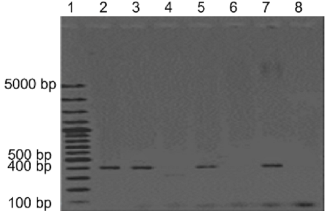 Tet (M) gene PCR amplification. Wells from left to right:1. Molecular weight marker 100bp; 2. E cloacae M2C2; 3. E cloacae M6C8; 4. E cloacae M3C4; 5. S, liquefaciens M3C5; 6. K, krsstnnae M7C8; 7. K kristinae M8C13; 8. negative control.