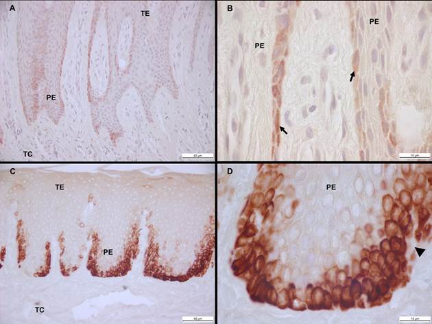 Expresi&oacute;n de la Citoqueratina 19 en tejido gingival. Epitelio gingival de sujeto periodontalmente sano. Flecha negra indica c&eacute;lulas basales positivas la CK-19 (A, B). Epitelio gingival de paciente con AGTO. Triangulo negro denota p&eacute;rdida de la integridad de la membrana basal (C, D). TE: tejido epitelial; TC: tejido conjuntivo; PE: prolongaci&oacute;n epitelial. Barra negra: 40 um (A, C) y I0 um (B,D). 