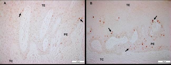 Detecci&oacute;n de Ki-67 en c&eacute;lulas sometidas a divisi&oacute;n celular en epitelio gingival de individuo sano (A) y paciente con AGTO (B). TE: tejido epitelial; TC: tejido conjuntivo; PE: prolongaci&oacute;n epitelial. Barra negra: 40 um (A, B). Fuente: 