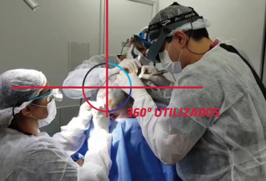 Posição obtida com os aparatos desenvolvidos; 360° de acessibilidade
							à cabeça
