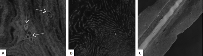Microscopia eletr&ocirc;nica de transmiss&atilde;o: A - membrana
                                de quitosa e xantana com as c&eacute;lulas (setas brancas) (12930x);
                                    B - membrana de quitosana e alginato (1293x);
                                    C - membrana de quitosana e alginato
                                (3597x)