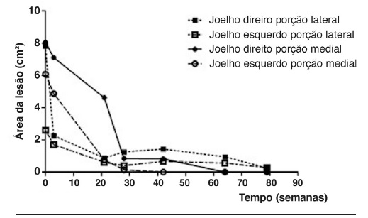 Evolu&ccedil;&atilde;o da cicatriza&ccedil;&atilde;o das &uacute;lceras; as setas indicam o momento da
                            aplica&ccedil;&atilde;o (semanas 0, 3, 6, 21, 28, 42 e 70). Nas les&otilde;es do joelho
                            direito foi utilizada membrana de quitosana-alginato e, nas do esquerdo,
                            quitosana- xantana