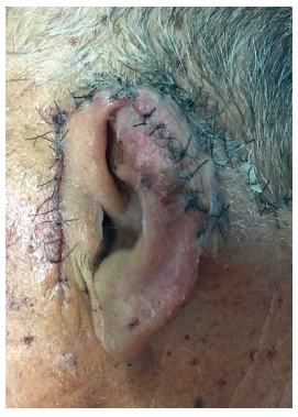 P&oacute;s-operat&oacute;rio imediato sem complica&ccedil;&otilde;es