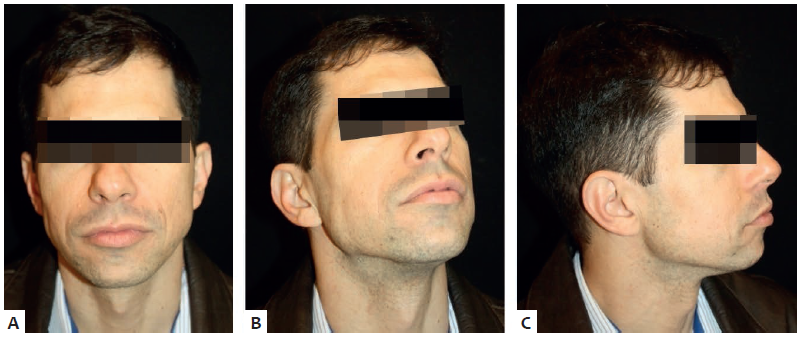 P&oacute;s-operat&oacute;rio de quatro anos