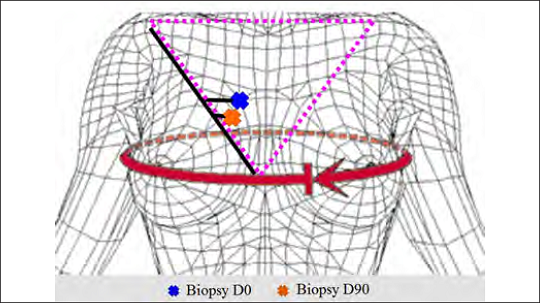 Áreas biopsiadas nos tempos D0 e D90