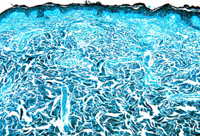 Fotomicrografia da coloração FM com magnificação de 100x demonstrando aspecto geral da qualidade da coloração