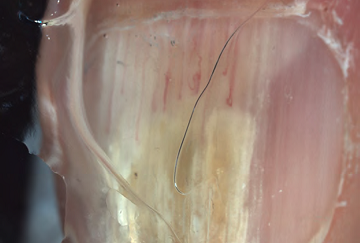 L&uacute;nula esbranqui&ccedil;ada com capilares no sentido longitudinal