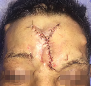 P&oacute;s-operat&oacute;rio imediato