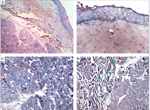 Língua: a) Fragmento da língua (corte vertical, Hematoxilina & eosina, 40x). b) Epitélio lingual (corte vertical, Hematoxilina & eosina, 100x.) c) Glândulas salivares, em detalhe (círculo vermelho) (corte vertical, Hematoxilina & eosina, 100x). d) Detalhe das fibras musculares estriadas (setas verdes) (corte vertical, Hematoxilina & eosina, 100x)