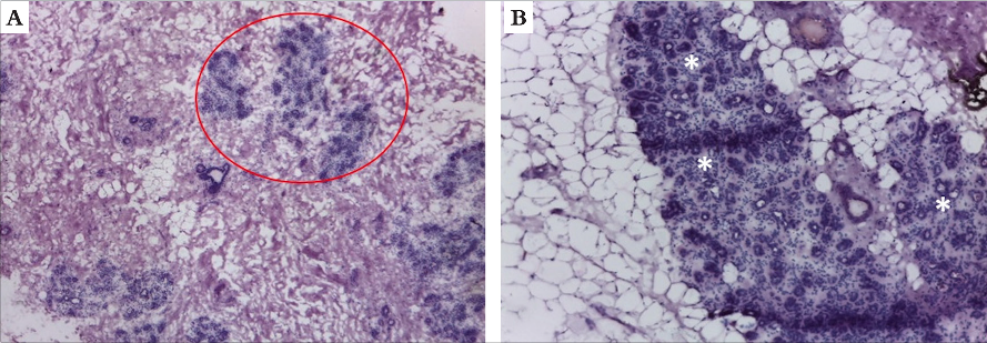 Mama: a) Tecido mamário, área fibroglandular, lóbulos glandulares em destaque (círculos) (corte horizontal, Hematoxilina & eosina, 40x). b) Tecido mamário, área com predomínio de tecido adiposo entremeando aglomerados glandulares (asteriscos) (corte horizontal, Hematoxilina & eosina, 100x)
