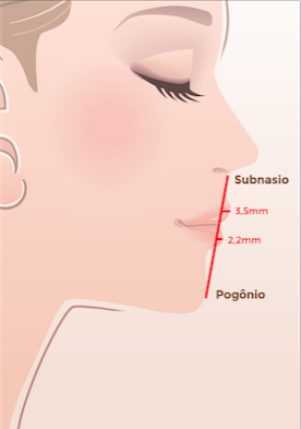 Proporção labial ideal para o perfil. Se uma linha reta é traçada do subnasio ao pogônio, o lábio superior deve se projetar 3,5 mm anterior à linha, e o lábio inferior deve se projetar 2,2 mm; o lábio superior deve projetar-se aproximadamente 1,3mm a mais que o lábio inferior