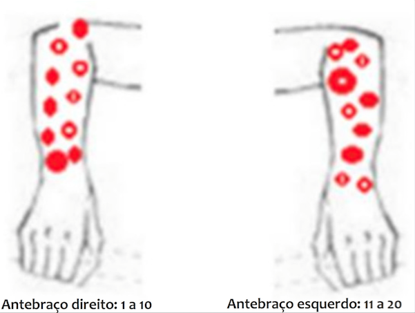 Modelo de marca&ccedil;&atilde;o das les&otilde;es