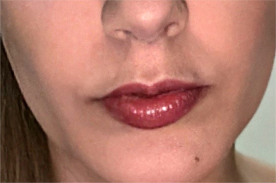 Aspecto prévio à infecção por
                        COVID-19