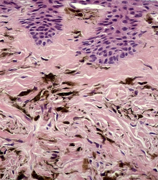 Detalhe em maior aumento