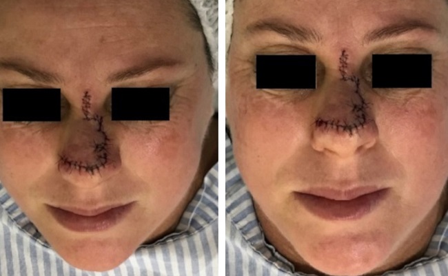 P&oacute;s-operat&oacute;rio imediato