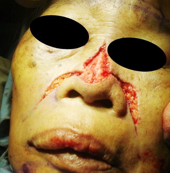 Antes da s&iacute;ntese total do retalho, foi realizado um avan&ccedil;o de teste,
							para checar a simetria e a precis&atilde;o do fechamento