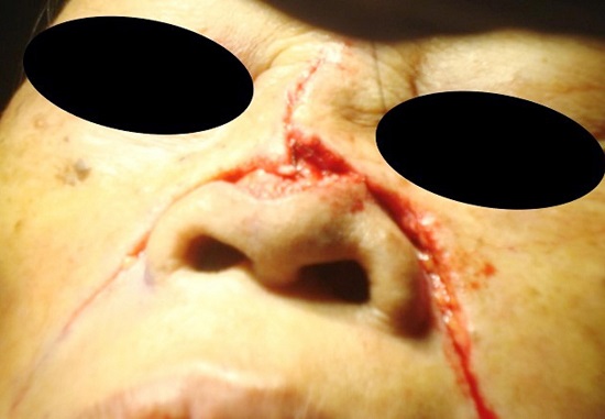 Antes da s&iacute;ntese total do retalho realizado avan&ccedil;o de teste para
							checar a simetria e a precis&atilde;o do fechamento