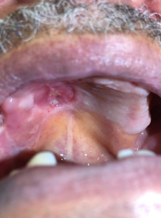 Resultado p&oacute;s-operat&oacute;rio