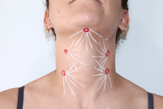 Demarcação da região cervical com cinco figuras de sete pontas