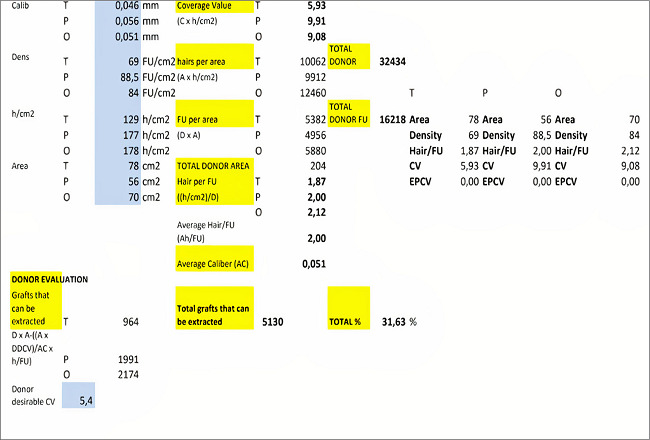 Estatísticas do Coverage Value (CV): os resultados do Hair
								Counter Software somados à espessura média dos cabelos das áreas
								doadoras temporal, parietal e occipital são usados para os
								resultados do CV. Para que não haja visualização do couro cabeludo,
								o CV deve ser maior que 5,4. Neste exemplo, o CV na área temporal é
								extremamente baixo (5,94), alertando para o risco de depleção
								cosmética futura. Este paciente possui um número total de UFs de
								aproximadamente 16.218. Mas, considerando suas medidas de área
								doadora segura, espessura dos folículos, densidade e coeficiente em
								cada área, o software CV considera que apenas 31,63% de UFs podem
								ser extraídas durante sua vida, ou seja, aproximadamente 5.130
								UFs