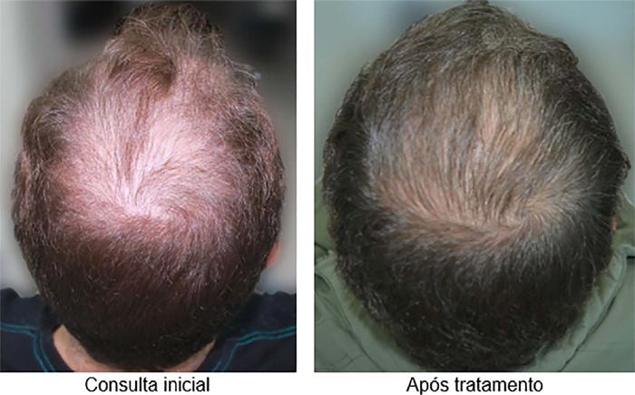 Imagem de foto padronizada dos pacientes