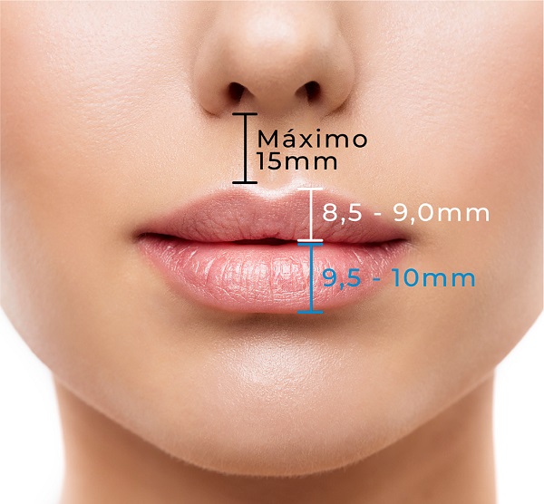Parâmetros anatômicos simplificados para preenchimento labial. A
							dimensão vertical do vermelhão do LS deve estar entre 8,5 e 9mm,
							enquanto a do LI fica entre 9,5 e 10mm, aumentando alguns mm ao nível do
							IT. O volume do vermelhão do LS deve ser de 75 a 80% do inferior,
							seguindo a proporção áurea. A altura das CF devem estar idealmente entre
							12 e 15 mm. A protrusão anterior do LS deve ser 1,5 a 2mm maior que a do
							LI