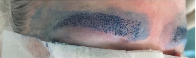 Demonstra&ccedil;&atilde;o das pr&eacute;-incis&otilde;es. Autoria pr&oacute;pria