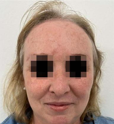 Cura oncol�gica e melhora est�tica