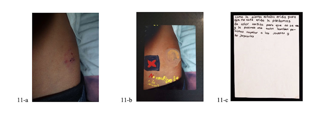 intervenci&oacute;n fotogr&aacute;fica sobre la violencia hacia ni&ntilde;os y j&oacute;venes