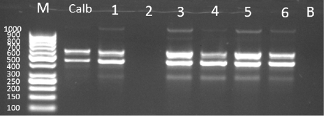 Multiplex PCR White and pink isolates. M: DNA ladder bp, Clus: Candida lusitaniae ATCC 34449, Cgui: Candida guilliermondii ATCC 6260, Cpar: Candida parapsilosis ATCC 22019, lanes 1-7; clinical strains, B; blank. 2and 3; Candida parapsilosis, 4; Candida lusitaniae