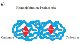 Estructura de la hemoglobina en β-talasemia