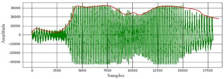 Fig.2. A speech frame of signal
