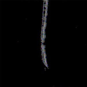 Imagen 7. De la serie: Anomala. Data Bending sobre imgenes de RM. (Autor, 2022).