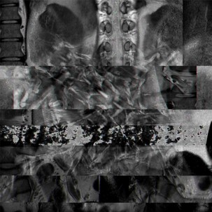 Imagen 11. De la serie: Anomala. Data Bending sobre imgenes de RM. (Autor, 2022).