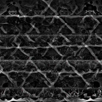 Imagen 14. De la serie: Anomala. Data Bending sobre imgenes de RM. (Autor, 2022).