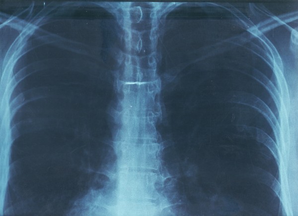 El dolor de la existencia en imagen de lo real.Radiografa digital. (Autor, 2022).