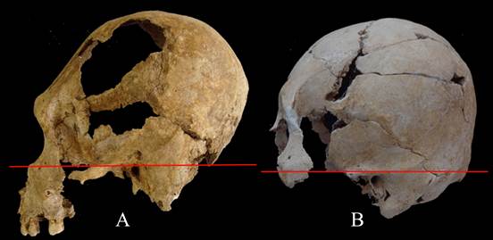 Cr&aacute;neos prehisp&aacute;nicos con el modelado cef&aacute;lico intencional, procedentes del sitio arqueol&oacute;gico Cop&aacute;n, Honduras.