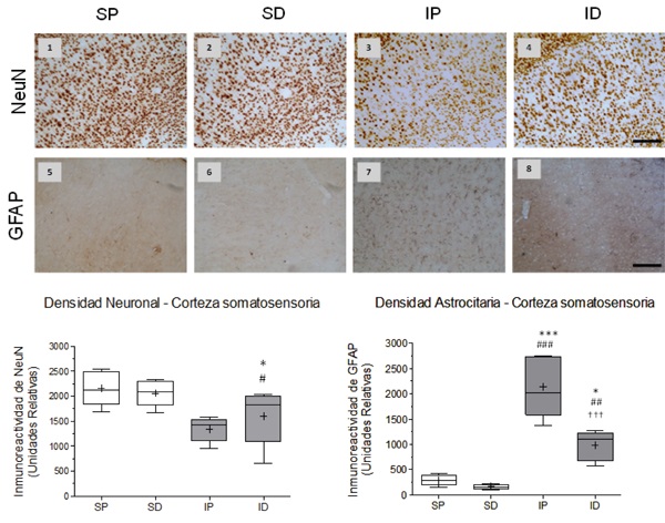 Effect of cerebral embolism and DMSO treatment on neuronal and astrocytic reactivity in the somatosensory cortex. A) Representative images of neuronal nuclear immune reactivity (NeuN) (1-4) and of astrocytic (GFAP) immune reactivity (5-8) from the groups: SP Sham + Placebo, SD: Sham + DMSO, IP: Ischemia + Placebo , ID: ischemia + DMSO. B) B) Statistics of the immune reactivity of NeuN in cerebral cortex. Significant differences between the IP/SP groups (* p <0.05) and IP/SD groups (# p <0.05) were observed. No differences were found due to the effects of DMSO treatment with respect to any of the groups. C) Statistics of immune reactivity of GFAP in the ipsilateral cortex. Highly significant differences were found between groups IP/SP (*** p <0.001), IP/SD (# # # p <0.001) and ID/IP (&dagger; &dagger; &dagger; p <0.001). In addition, significant differences were observed between the ID/SP groups (* p <0.05) and highly significant differences between the ID group and its SD control (# # p <0.01). Data are expressed as the mean &plusmn; SEM. Scale bar = 50 microns
