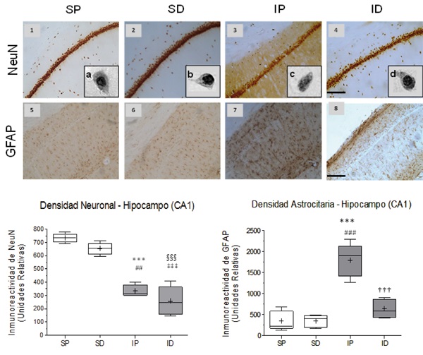 Effect of cerebral embolism and DMSO treatment on neuronal and astrocytic reactivity in the hippocampal CA1 area. A) Representative images of neuronal nuclear immune reactivity (NeuN) (1-4) and of the astrocytic immune reactivity (GFAP) (5-8) from the groups: SP (Sham + Placebo), SD, (Sham + DMSO), IP (Ischemia + Placebo), and ID (ischemia + DMSO). A, b, c and d correspond to magnified images of individual cells of the hippocampal CA1 region of the respective groups (100X in gray scale). (d). Disintegration of the nuclear chromatin and of the surrounding cytoplasm (c) was found as an effect of the ischemia differing from the control (a, b). DMSO preserves neuronal structure and the nuclear integrity after the ischemic event (d). B) Statistic for the immune reactivity of NeuN. Highly significant differences were observed between the IP/SP groups (*** p <0.001), ID/SP (&sect; &sect; &sect; p <0.001), ID/SD (&Dagger; &Dagger; &Dagger; p <0.001) and significant differences between the groups IP/SD (# # p <0.01). C) Statistic of the immune reactivity of GFAP. Highly significant differences were found between IP/SP groups (*** p <0.001), IP/SD groups (# # # p <0.001) and ID/IP groups (&dagger; &dagger; &dagger; p <0.001). Data are expressed as the mean &plusmn; SEM. Scale bar = 50 microns.
