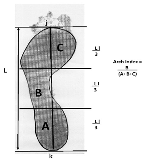 Outline of the footprint, excluding the toes, is traced with a scanner using AutoCad&reg; 2013. It is then divided into into three equal sections by the parallel lines perpendicular to j and k. The arch index (AI) is calculated as the relation between the midfoot area B and the area of the whole foot excluding the toes (A + B + C).