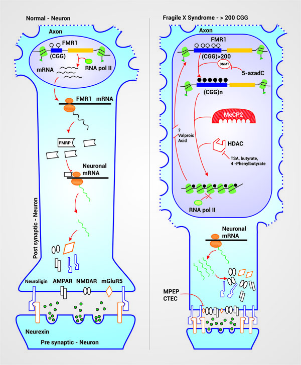  Therapeutic targets and FXS physiopathogenesis. In a neuron with a normal range of CGG repeats in the FMR1 gene, there is a euchromatin structural conformation which allows the entry of transcription machinery, due to the acetylation of histones H3 and H4. This conformation allows the normal production of the FMRP, protein that inhibits mRNA translation of some neuronal proteins as Neuroligin, NMDA Receptor (NMDAR), AMPA Receptor (AMPAR) and mGluR5 receptor among others. The expansion above 200 repeats leads to the detection of the CpG islands by DNA Methyl-transferases (DNMT) that add methyl groups to the cytosines of the CGG sequence and the promoter which silences the gene. This methylated cytosines are recognized by the MeCP2 which attracts and activates Histone Deacetylases (HDAC) that cleaves acetyl groups from histones H3 and H4 near the affected segment thus condensing the chromatin. Together, this changes silence the gene allowing the excessive production of neuronal proteins causing neuronal hyperexcitability, spinal dysmorphogenesis and successive clinical manifestations. 5-azadC is a drug that inhibits the DNMT preventing cytosine methylation. TSA, butyrate and 4-phenylbutyrate inhibit the HDAC therefore acting synergically with 5-azadC. Valproic acid seems to reactivate silenced genes but its mechanism has not been yet described. Inhibitors of mGluR5 allows to reduce its hyperexcitation, produced by its overproduction, and the consequences it carries.