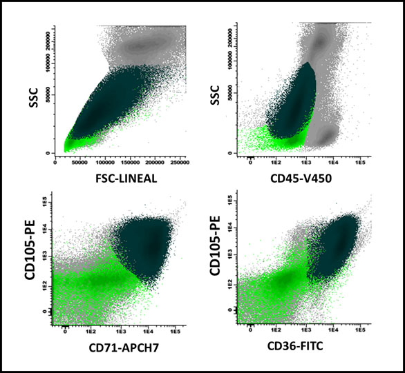 Maturation arrest in erythroid series in a patient with megaloblastic anemia: There is a predominance of CD105+ precursors (81% of the total erythroblast population, with high FSC/SSC ratio) in dark green, over the more mature ones (light green), which in turn expressed CD36 and CD71 (lower portion of the figure) heterogeneously.