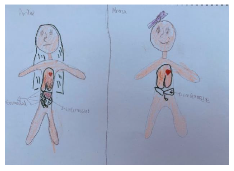 Disease representation (Girl, 16-year-old)