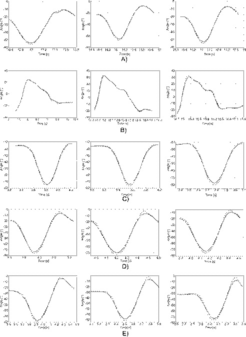 Performance of controller (dashed line) for tracking the artificial FAP (solid line) for differerent gestures at three different speeds. The starting and ending points of each signal were the TO and IC, respectively. A)&ldquo;Gait&rdquo;, MSE=0.0828. B)&ldquo;Up stairs&rdquo;, MSE=0.0487. C)&ldquo;Down stairs&rdquo;, MSE=0.1591. D)&ldquo;Up hill&rdquo;, MSE=0.1192. E)&ldquo;Down hill&rdquo;, MSE=0.1819.