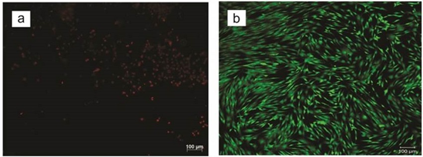 Two color fluorescence cell viability assay taken two days of cell culture, QS / FGS scaffold (a) and positive control of cell formation (b).
