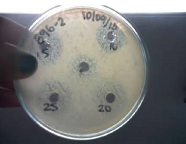 Bacterial inhibition test of the population in wetlands