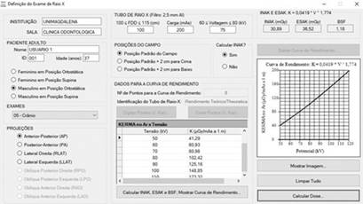 Visualización de la configuración y las opciones de CALDose_X. 