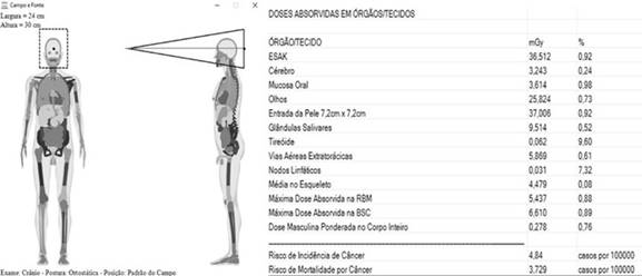 Visualización del campo de radiación, las dosis absorbidas en órganos y los riesgos de incidencia y mortalidad por cáncer arrojadas por CALDose_X. 